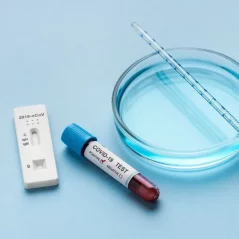 Antigenní test COVID-19